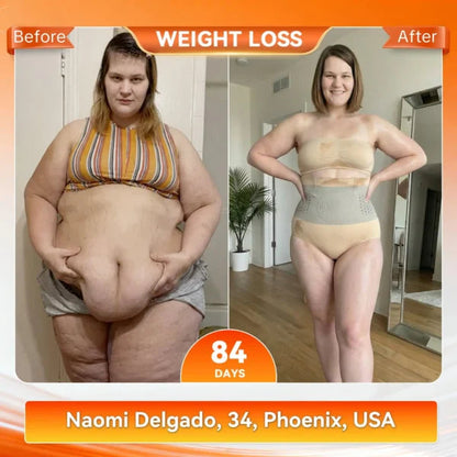🥳2026 HOT SALE🥳💞95K+ SOLD!🌸🧘‍♀️Thermogenic Tummy Control Shorts – 30‑min daily wear, activates warmth & boosts circulation. Supports firmer, smoother contour. No gym needed. A smart shapewear choice. 👵✨