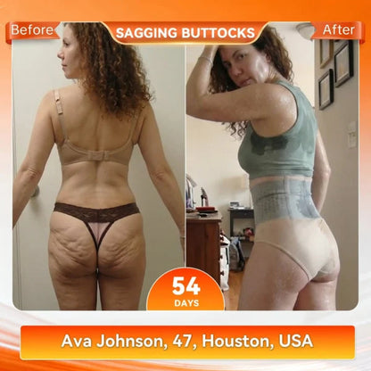 🥳2026 HOT SALE🥳💞95K+ SOLD!🌸🧘‍♀️Thermogenic Tummy Control Shorts – 30‑min daily wear, activates warmth & boosts circulation. Supports firmer, smoother contour. No gym needed. A smart shapewear choice. 👵✨
